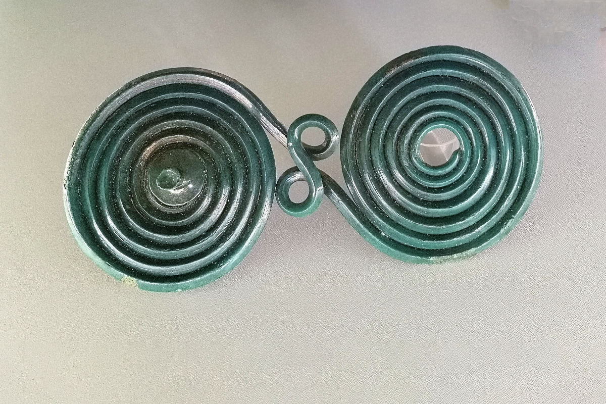 example of fibula